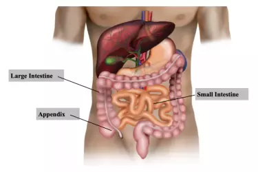 best hospital for appendix surgery in Katihar, best doctor for appendix treatment in Katihar, cost of appendix surgery in Katihar