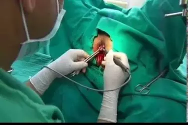 best hospital for piles surgery in Katihar, best doctor for piles fissure treatment in Katihar, cost of piles fissure surgery in Katihar